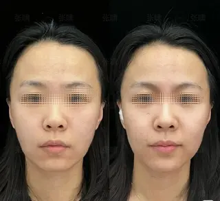 マツエク・マツパ aliaハイフ&水光ジェットサロン所属・aliaハーブ水光店 エステティシャン募集のエステ・リラクイメージ