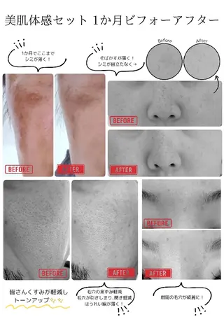 De I'm (デ・アイム) 新潟北所属・大澤 美咲枝のエステ・リラクイメージ