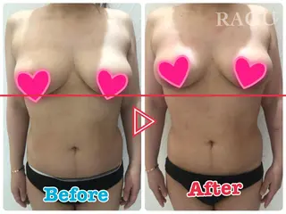 RAGU BEAUTY所属・原口 彩子のエステ・リラクイメージ