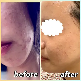 aimer beautyのエステ・リラクイメージ