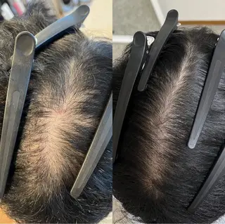 Blooming所属・LOUISE. ／肌質・頭皮のエステ・リラクイメージ