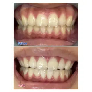 M渋谷店所属・M渋谷 ホワイトニングのエステ・リラクイメージ