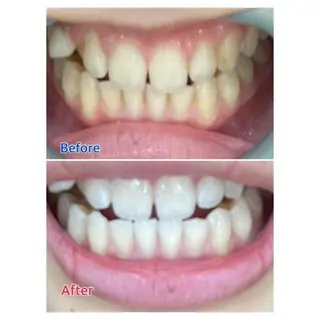 M渋谷店所属・M渋谷 ホワイトニングのエステ・リラクイメージ