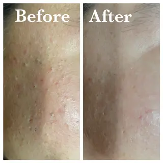 HAKUBI フェイシャルサロンのエステ・リラクイメージ