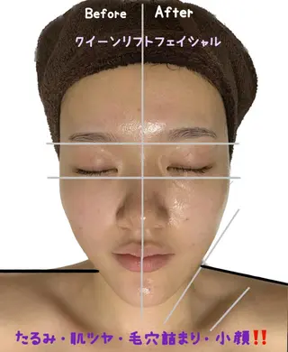 ヴィーナス ビューティーのエステ・リラクイメージ