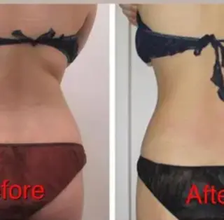 全身痩身✨ キレイサローネ新宿のエステ・リラクイメージ