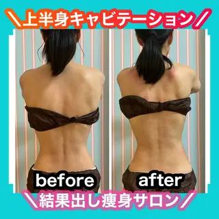 痩身/脱毛/ネイル HARUKAのエステ・リラクイメージ