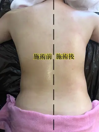 ❤︎MN❤︎ モンのエステ・リラクイメージ