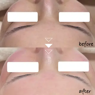 韓国肌管理専門店　White labo 新潟店所属・韓国肌管理専門店 Rihoのエステ・リラクイメージ