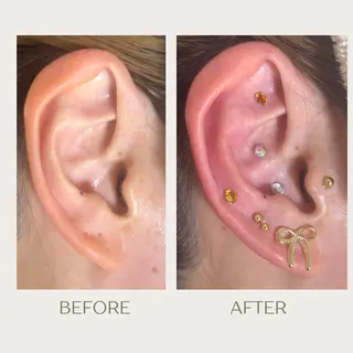 ピーリングケア 🤍moekoのエステ・リラクイメージ