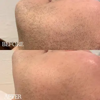 メンズ RICCO 堺東所属・RICCO 堺の眉毛・アイブロウイメージ