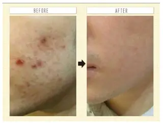 アロハーブ 韓国肌管理のエステ・リラクイメージ