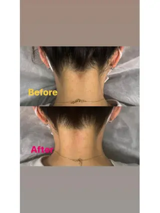 LULA池袋店 HAYASAKAのエステ・リラクイメージ