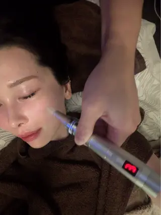 圧倒的たるみ改善 美容鍼エステのエステ・リラクイメージ