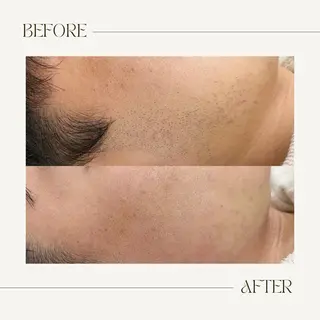 脱毛専門サロンELIXIR（ｴﾘｸｻｰ）所属・脱毛&ホワイトニング ELIXIR×ULTのエステ・リラクイメージ