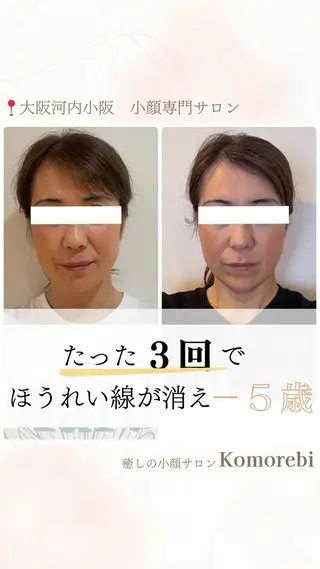 営業電話❌小顔サロン Komorebiのエステ・リラクイメージ