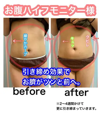 痩身/脱毛/ネイル HARUKAのエステ・リラクイメージ