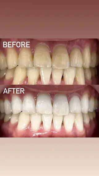 LBSホワイトニング 銀座店💎店長浦和のその他イメージ