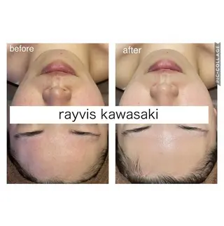 🎀美肌サロン レイビス川崎店🎀のエステ・リラクイメージ