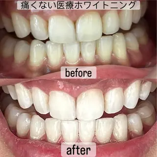 whitening salon yatto.所属・ホワイトニングサロン yatto.のその他イメージ