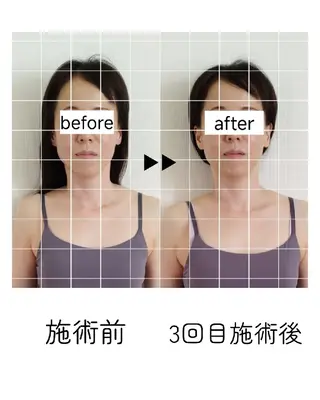 桜井市｜小顔・ 美容矯正 madoiのエステ・リラクイメージ