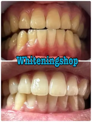 ホワイトニングショップ伊丹店所属・ホワイトニング ショップ伊丹店のその他イメージ