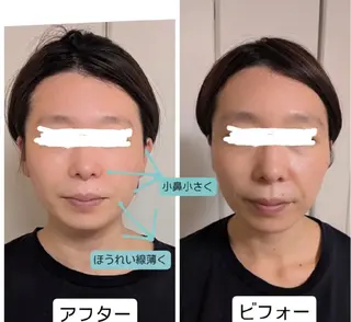 小顔 カリーナのエステ・リラクイメージ