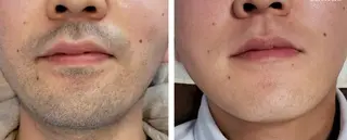 メンズ Beauty Salon Moonstone所属・Moonstone 男女•キッズ脱毛のエステ・リラクイメージ