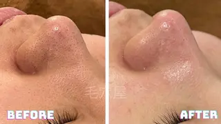 毛穴/毛穴洗浄専門 エミルカ船橋のエステ・リラクイメージ