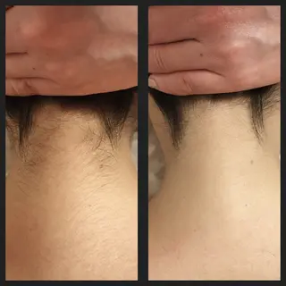 エステサロン Re：Charge所属・Re:Charge 古川小百合のエステ・リラクイメージ