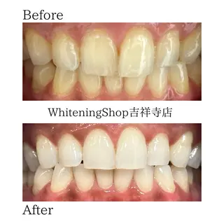 ホワイトニング ショップ吉祥寺店のエステ・リラクイメージ