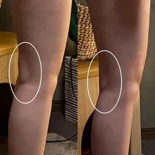 lymph care 'Welnəsのエステ・リラクイメージ