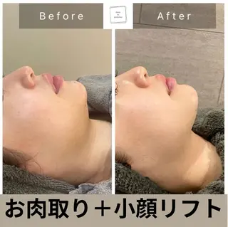 salon de perfectionのエステ・リラクイメージ