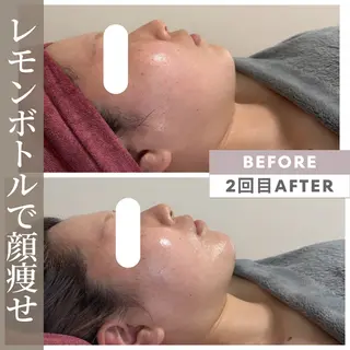 小顔矯正専門店 【RED】池田のエステ・リラクイメージ