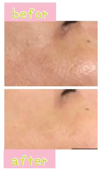 癒し腸もみサロン シャユーム　ゆきなのエステ・リラクイメージ