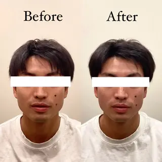 メンズ Hari Lounge恵比寿所属・chika🦋 ハリラウンジ恵比寿のエステ・リラクイメージ