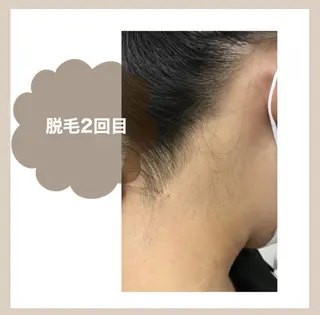 RinRin 甲府店のエステ・リラクイメージ