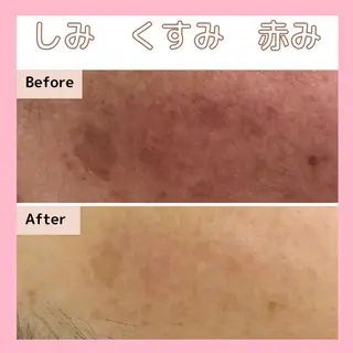 エステサロン　Sブランペタル所属・三沢市エステサロン Sブランペタルのエステ・リラクイメージ