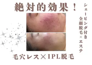 🎀美肌ケアサロン 🎀レイビス銀座店のエステ・リラクイメージ