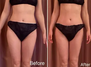 INDIBA Salon Frangipani 新宿所属・INDIBA サロン フランジパニ新宿のエステ・リラクイメージ