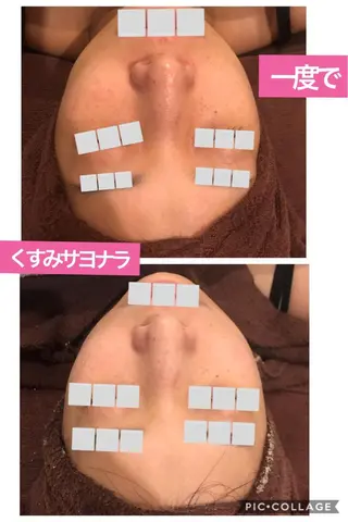 メンズ 四つ星サロン🎖 腸＆ニキビケアに特化のエステ・リラクイメージ