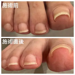 ネイル S Mihoのネイルデザイン