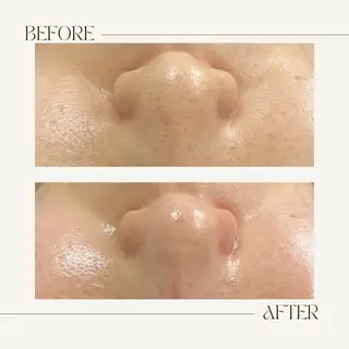 1st｜フェイシャル エステ専門店のエステ・リラクイメージ