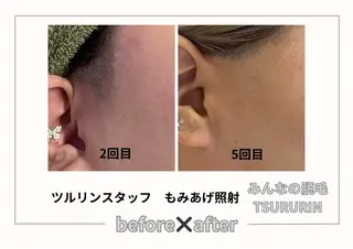 みんなの脱毛ツルリン ☀️船橋店☀️のエステ・リラクイメージ