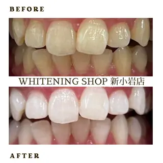 メンズ ホワイトニング ショップ新小岩店のその他イメージ