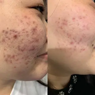 ライトケアサロン 表参道店① 佐々木のその他イメージ