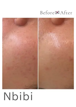 韓国🇰🇷価格 サロン_Nbibiのエステ・リラクイメージ