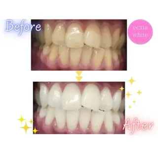 セルフホワイトニング エクシア武蔵小杉店のその他イメージ