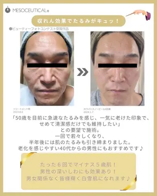 RinRin 豊田店のエステ・リラクイメージ