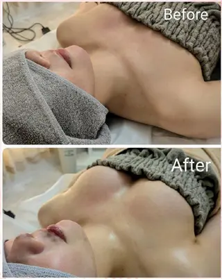 Myua ミュア所属・Myua ミュアのエステ・リラクイメージ